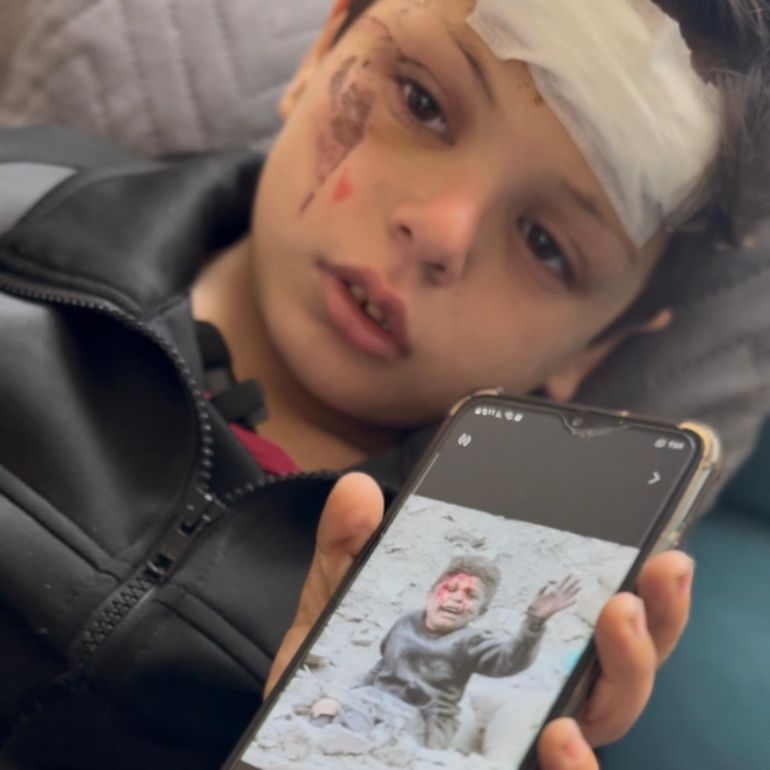 **داخلية*** الطفل علي فرج الذي تداول له النشطاء مقطعا مصورا حين قذفته الغارة على سطح المنزل المجاور بعدما فقد ١٩ فردا من عائلته، برفقة أمه