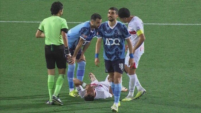 طبيب الزمالك يكشف تفاصيل إصابة ثلاثي الفريق خلال مواجهة بيراميدز طبيب الزمالك يكشف تفاصيل إصابة ثلاثي الفريق خلال مواجهة بيراميدز