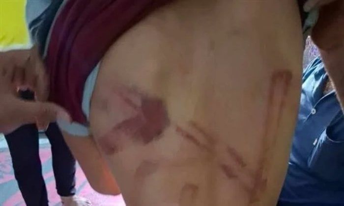 نام في منزل والدته بعد الطلاق.. التحقيق في تعدي أب بالضرب المبرح على طفله بالمنوفية نام في منزل والدته بعد الطلاق.. التحقيق في تعدي أب بالضرب المبرح على طفله بالمنوفية