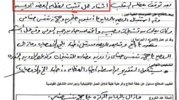 بورسعيد | التحقيق في واقعة توقف قلب شاب خلال عملية جراحية