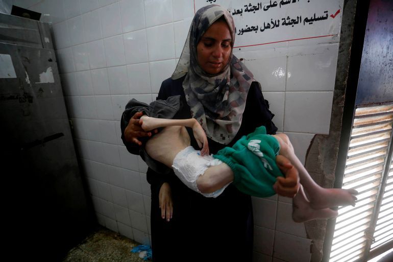 توفي الطفل الفلسطيني تامر شحيبر، الثلاثاء، في 
