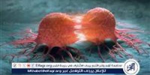 ما يجب فعله لتقليل خطر الإصابة بالسرطان - الكويت الاخباري