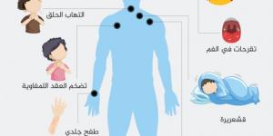 كيف يخترق فيروس نقص المناعة البشرية الخلايا المناعية ويختطفها؟ - الكويت الاخباري