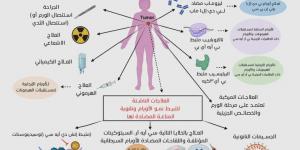 جزيئات النانو تُحدث ثورة في تشخيص وعلاج سرطان الثدي - الكويت الاخباري