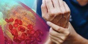 خطر على القلب.. علامات مرئية لارتفاع الكوليسترول في الدم - الكويت الاخباري