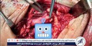 مدكور يشيد بجهود الفريق الطبى بمستشفى أجا في إنقاذ شاب من إصابة قاتلة بالرقبة - الكويت الاخباري