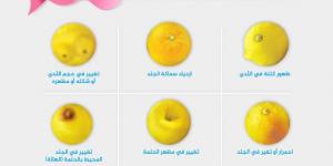 الذكاء الاصطناعي يساعد على تحديد مدى استفادة مريضات سرطان الثدي من أدوية البروتين هير2 - الكويت الاخباري