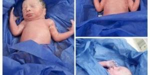 لأول مرة في المنيا.. ولادة نادرة لثلاثة توائم بمستشفى العدوة المركزي - الكويت الاخباري