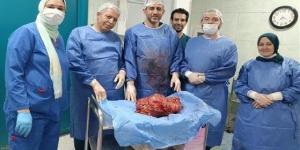 بوزن 15 كجم.. فريق طبي مصري ينجح في استئصال ورم من معدة مريض - الكويت الاخباري
