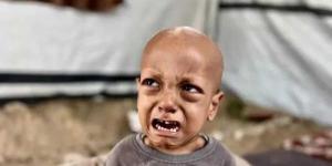 وفاة الطفل الفلسطيني صاحب مقولة ”أنا جعان” - الكويت الاخباري