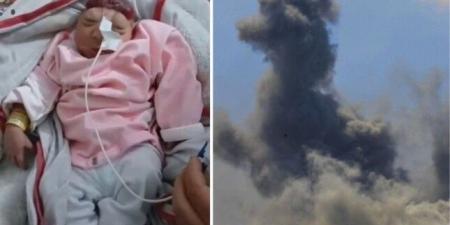 ولادة طفلة بلا دماغ مع تزايد ظاهرة "تشوه الأجنة" في قطاع غزة - الكويت الاخباري