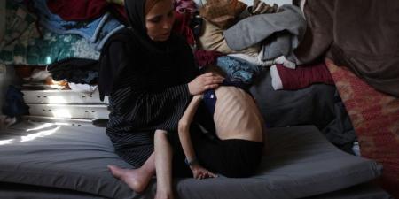 7 شهداء في غزة بينهم عائلة كاملة والجوع ينهش أجساد الأطفال - الكويت الاخباري