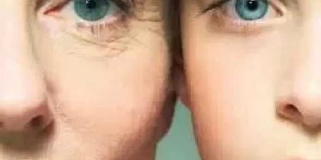 ”فوضى تحت الجلد”.... الوجه الآخر لمراكز التجميل في مصر - الكويت الاخباري