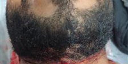 القبض على عاطل بالفيوم تعد على عامل بمحل كشري وأصابة بحرخ ذبحي بالرقبة - الكويت الاخباري