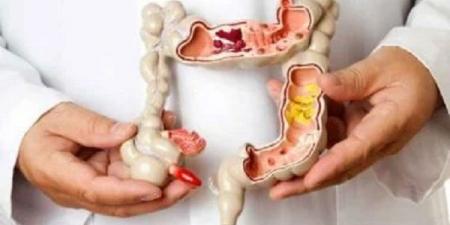 خطوة بسيطة قد تنقذك من سرطان الأمعاء #الصحة #منوعات #اخبار_الصحة #اخبار_منوعة #لايف_ستايل #الجمهورية_أون_لاين - الكويت الاخباري