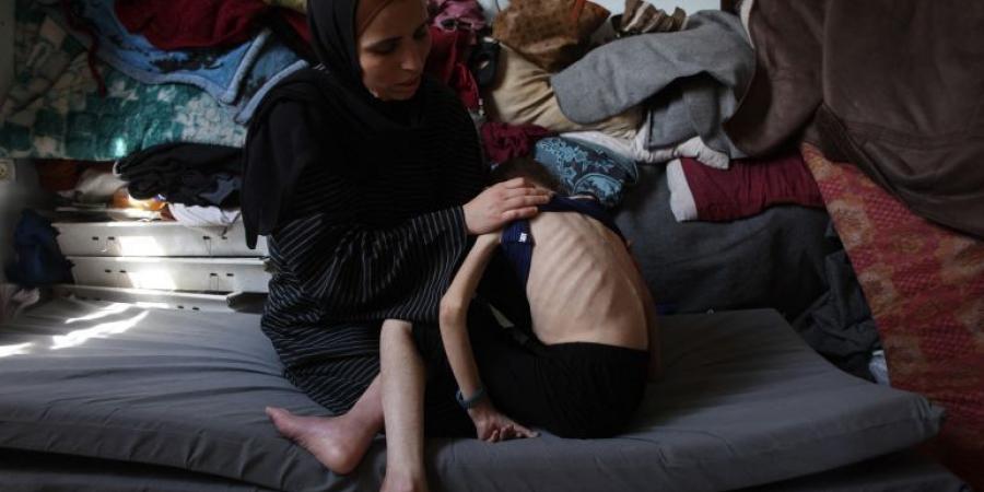 7 شهداء في غزة بينهم عائلة كاملة والجوع ينهش أجساد الأطفال - الكويت الاخباري
