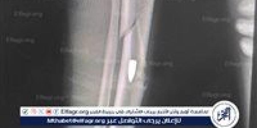 أصيب بطلق نارى يوم العيد..مستشفى قنا العام ينقذ شابًا من مضاعفات خطيرة بالساق - الكويت الاخباري