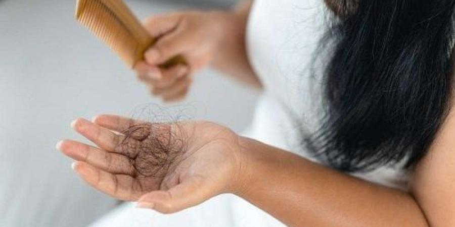 أفضل 10 شامبو ضد تساقط الشعر طبي وأكثر مبيعاً في لبنان 2025 - الكويت الاخباري