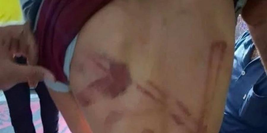 نام في منزل والدته بعد الطلاق.. التحقيق في تعدي أب بالضرب المبرح على طفله بالمنوفية - الكويت الاخباري