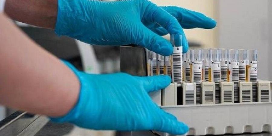 روسيا تطور لقاحات ضد السرطان .. تفاصيل - الكويت الاخباري