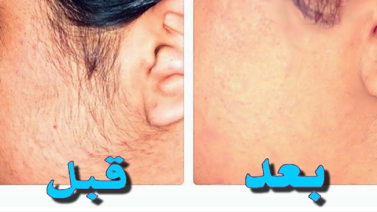 اكتشفي أسرار إزالة الشعر بطرق سهلة وطبيعية.. جمال ونعومة بدون كيماويات!