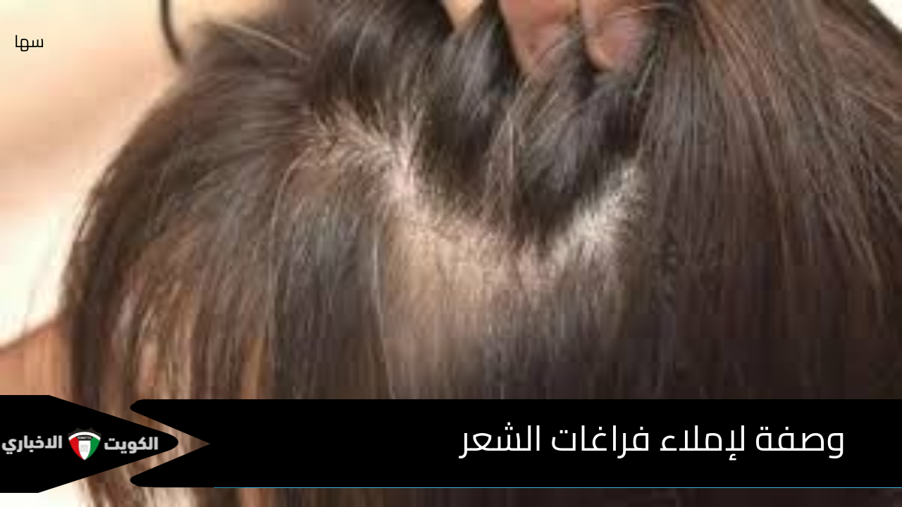  شعرك هيتقل زى الهنود.. علاج فراغات الشعر بأفضل أنواع الزيوت الغير مكلفة